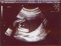 Its a boy